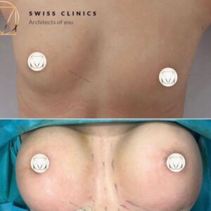 Medical Tourism In Romania Cosmetic Procedures And Surgery Swiss