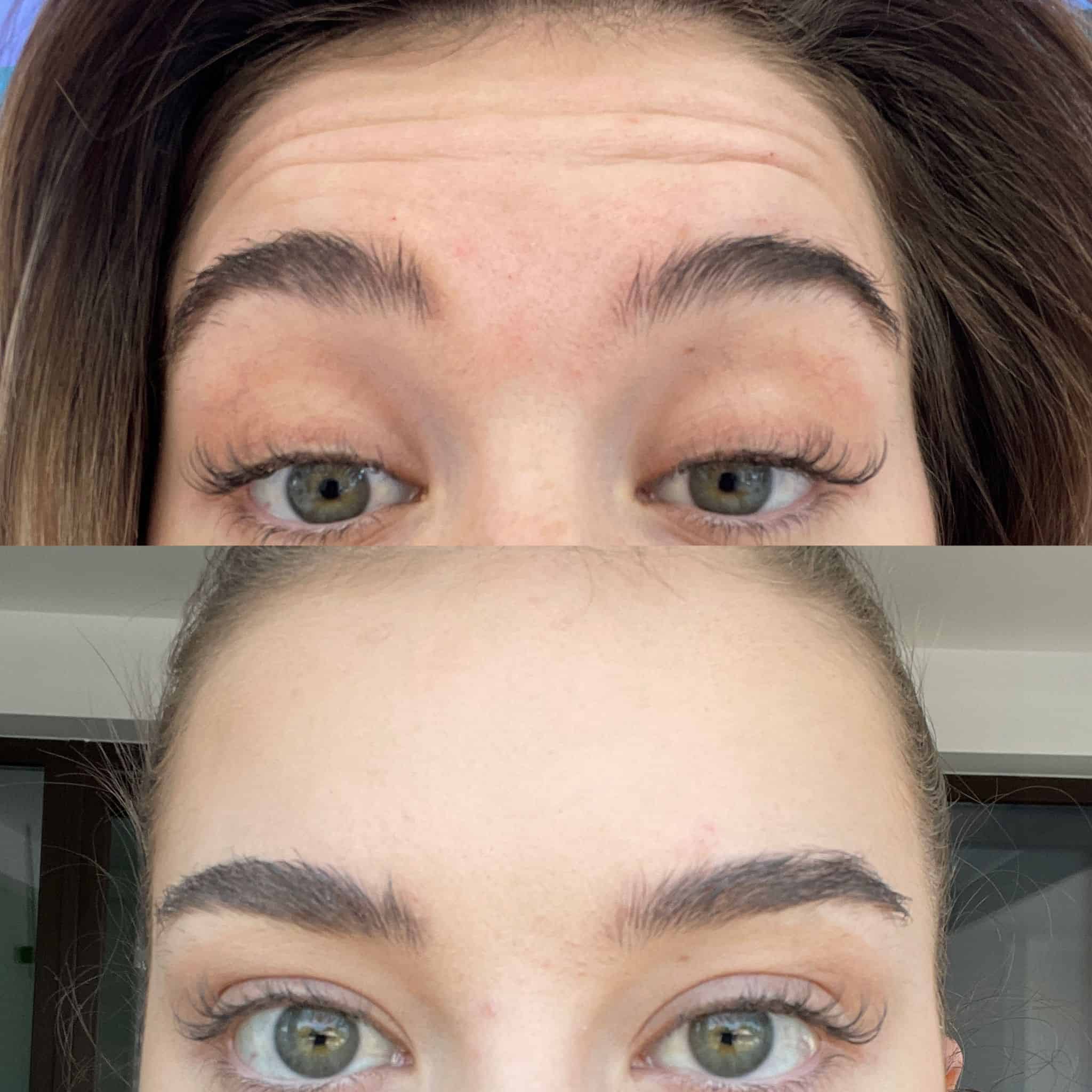 Stergerea-ridurilor Swiss Clinics