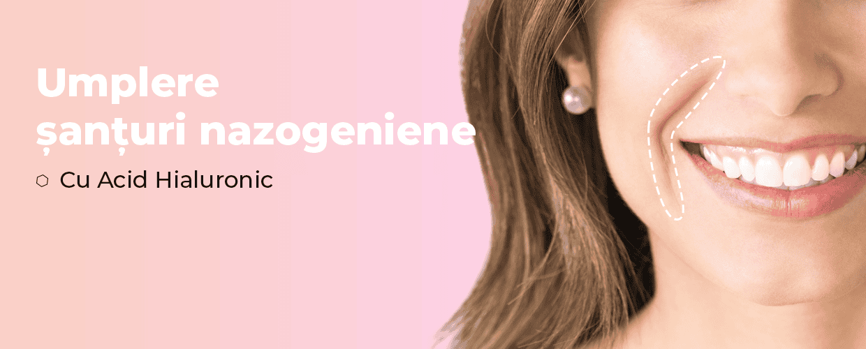 Umplere-șanțuri-nazogeniene Swiss Clinics