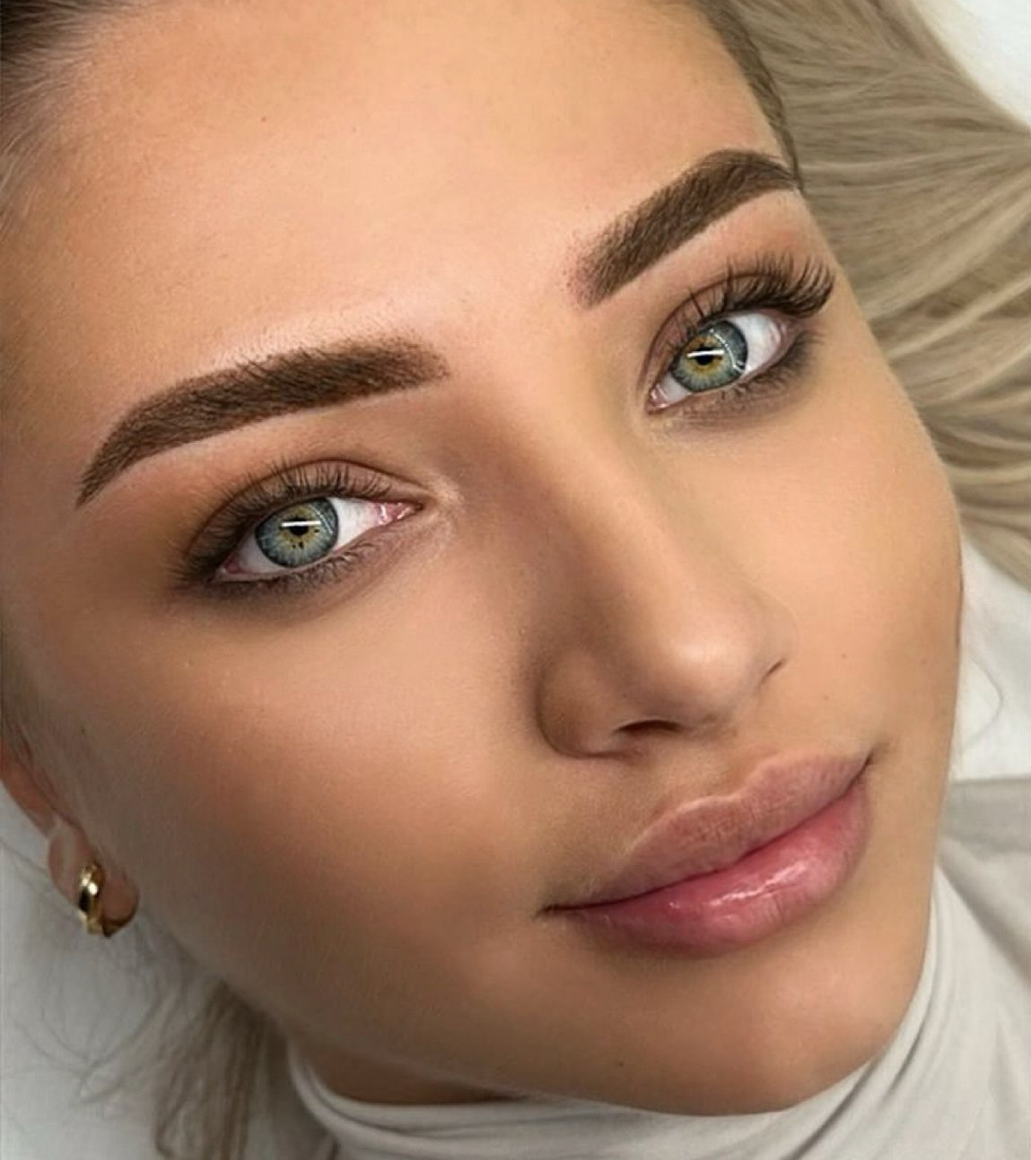 Volumizare _ 3-01 Swiss Clinics