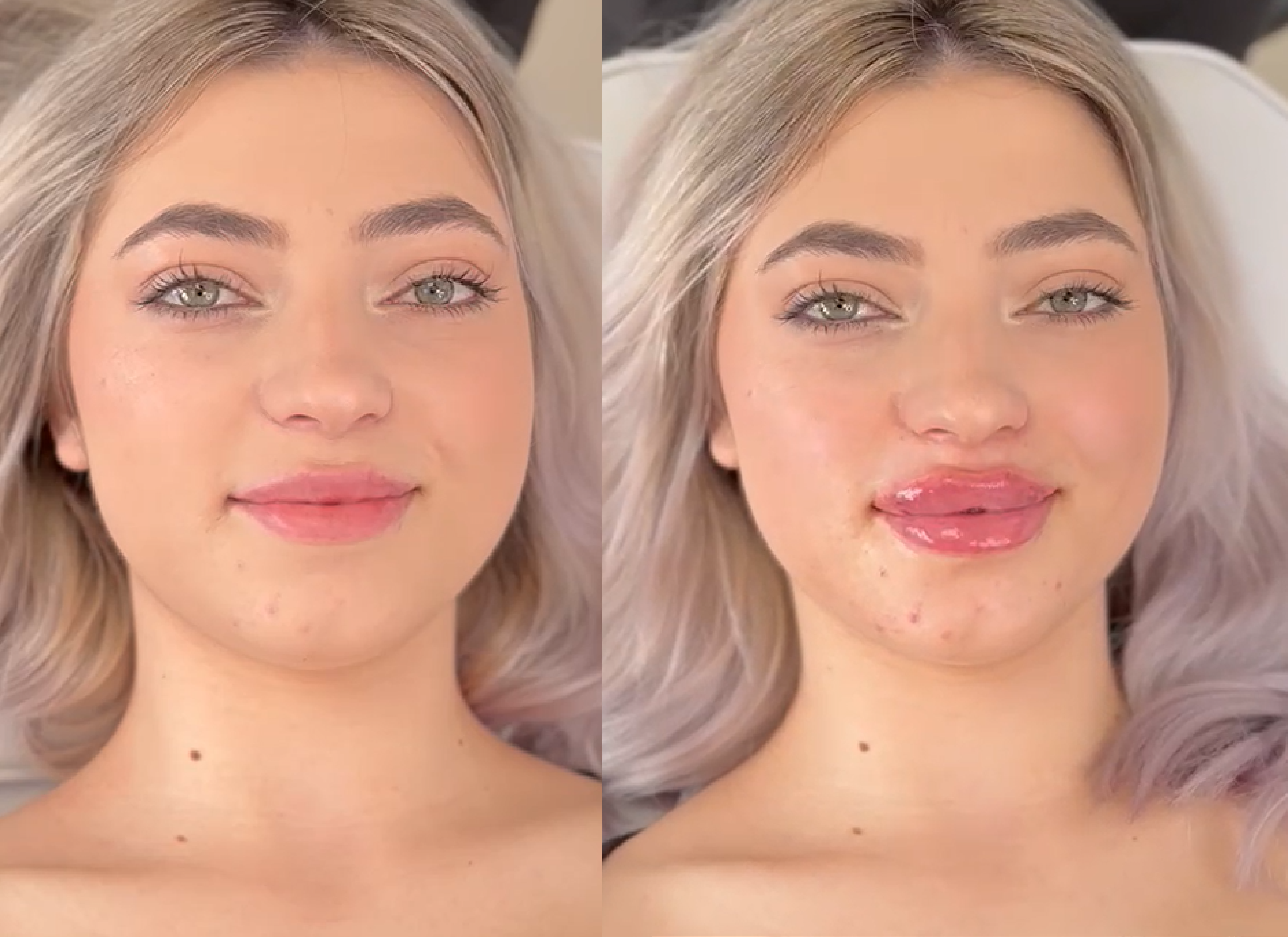 colaje-01 Swiss Clinics