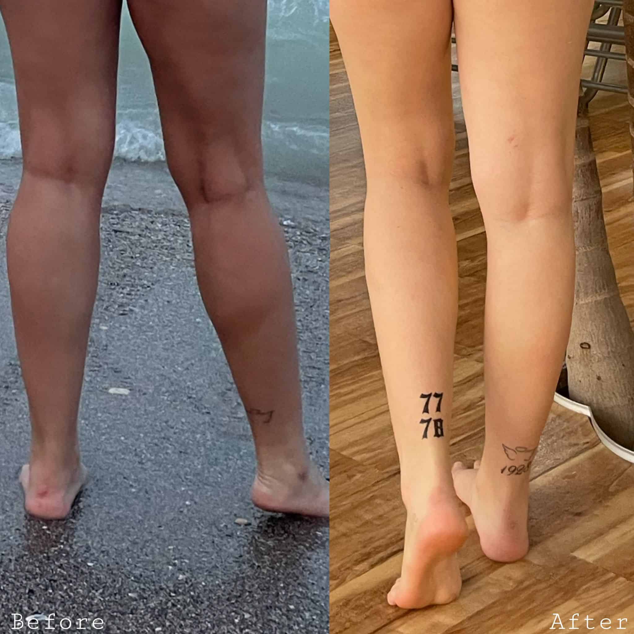 gambe 1 Swiss Clinics